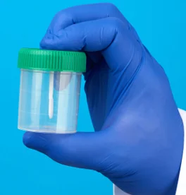 Urine / Stool Cups